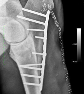 The Locking Compression Plating system